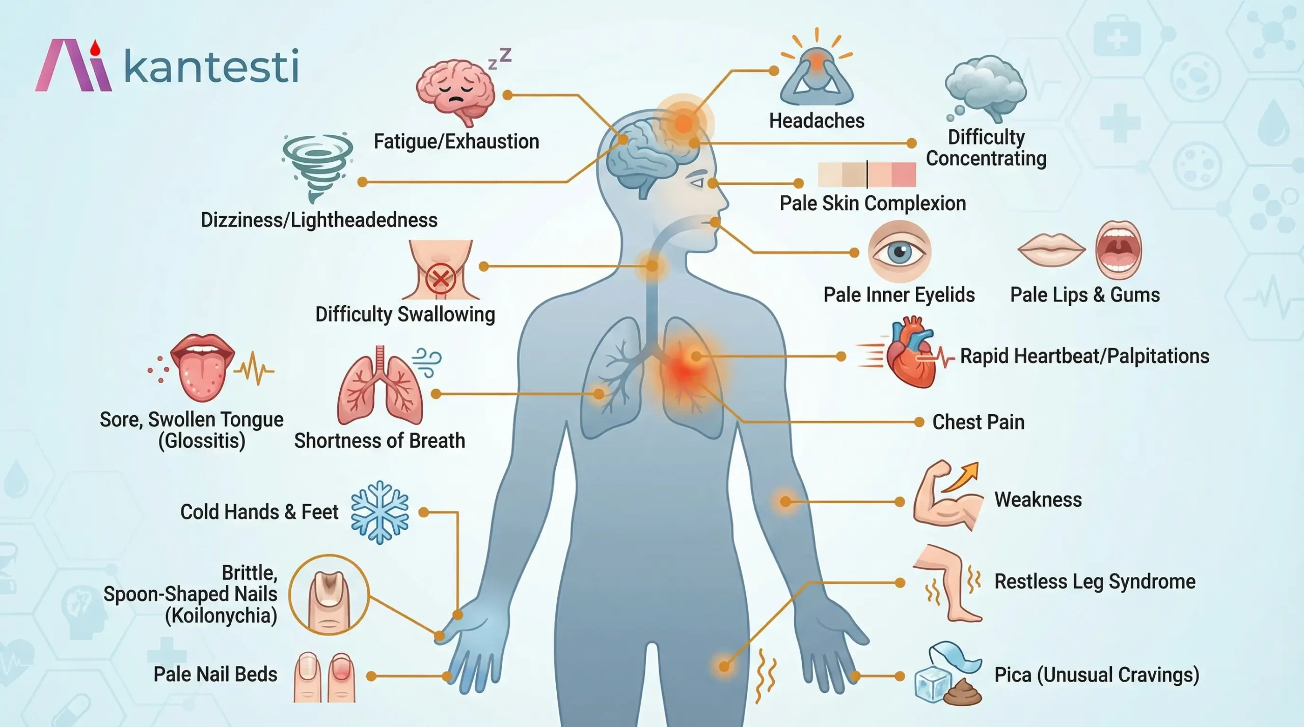 Iron deficiency symptoms infographic showing fatigue, pale skin, brittle nails, shortness of breath, dizziness, cold hands and feet, and other common anemia signs