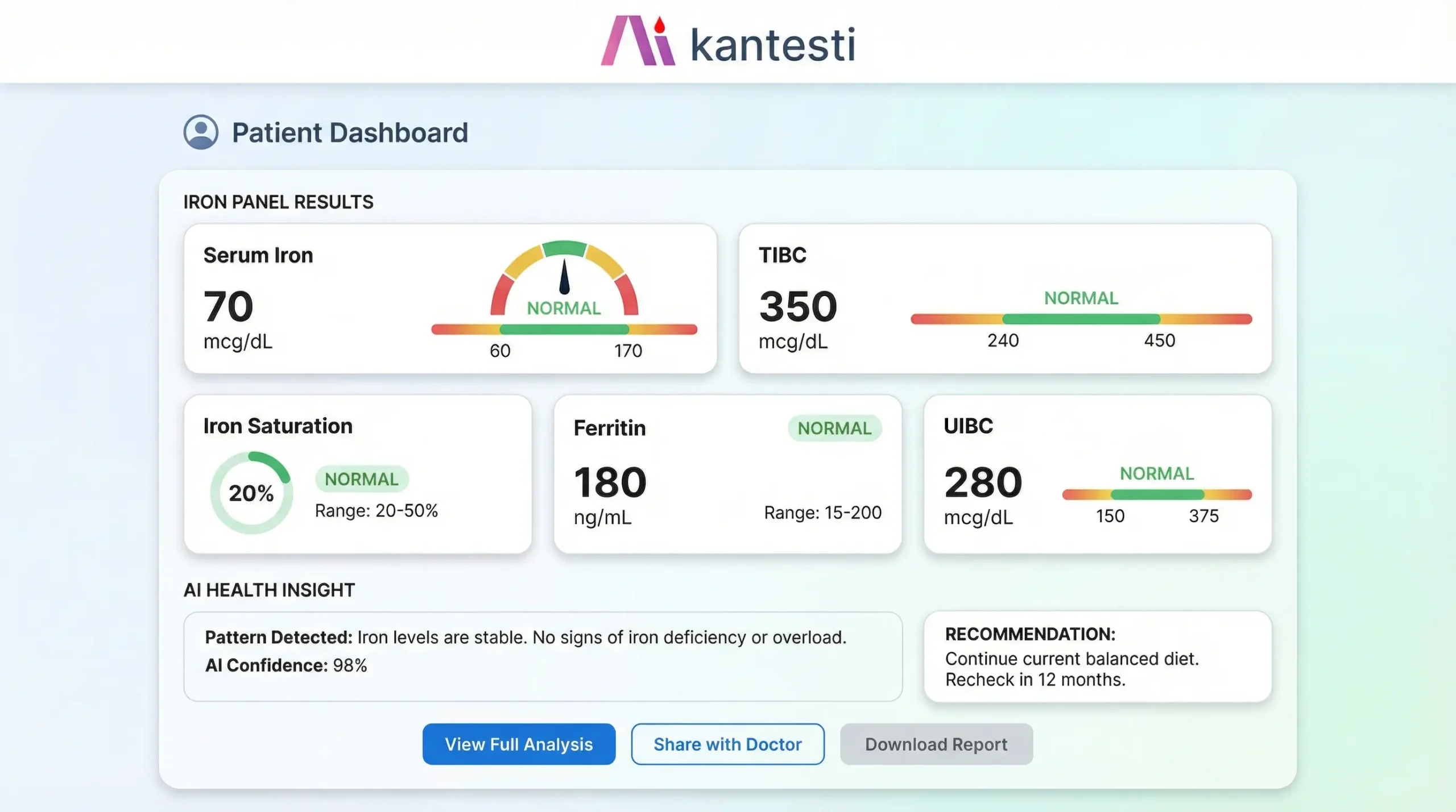 Kantesti AI iron panel analysis interface showing comprehensive interpretation of TIBC, iron saturation, serum iron, ferritin, and UIBC with personalized health insights
