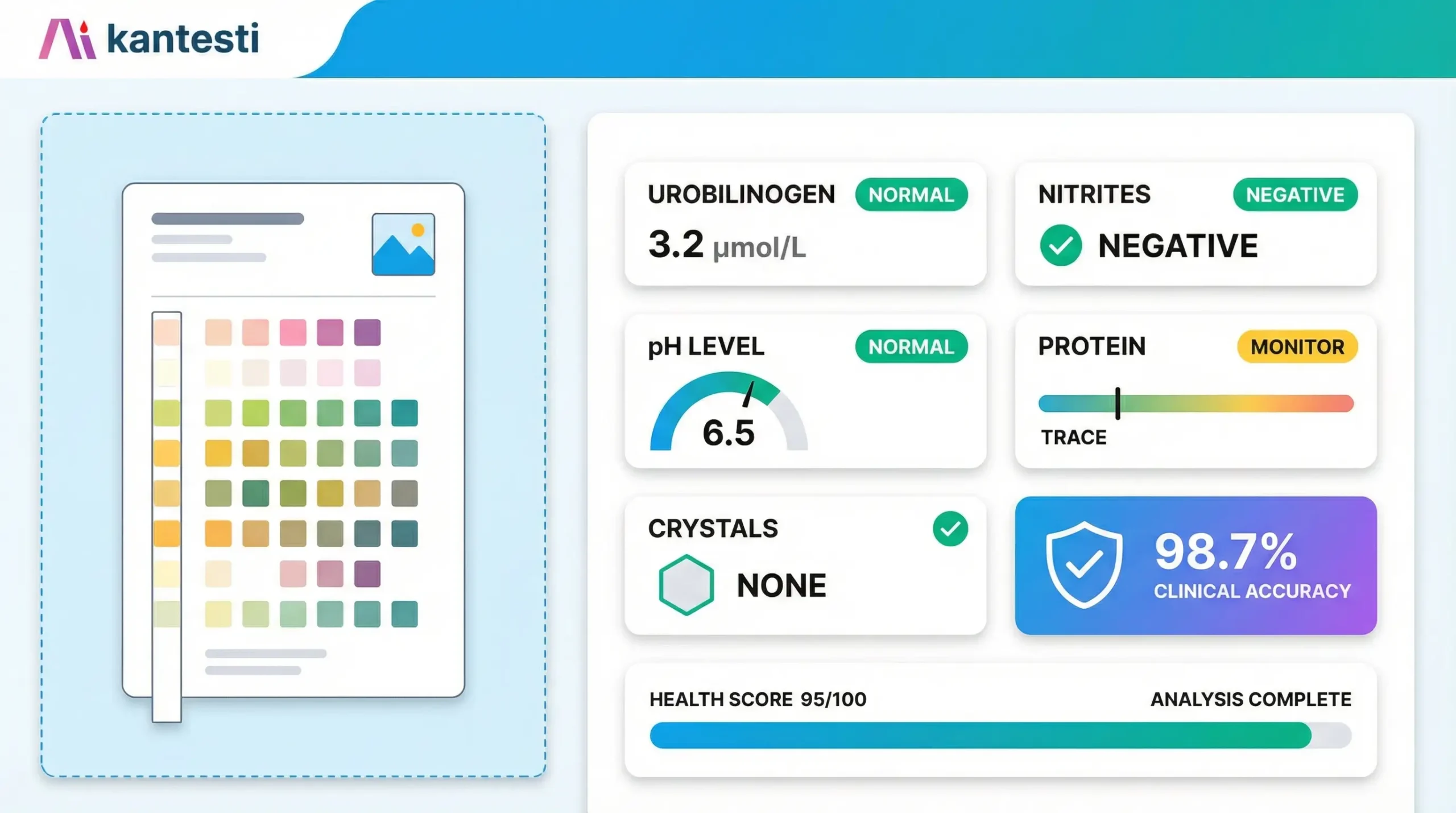 Διεπαφή ανάλυσης ούρων Kantesti AI που εμφανίζει έναν ολοκληρωμένο πίνακα ελέγχου ερμηνείας εξετάσεων ούρων με παραμέτρους ουροχολινογόνου, νιτρωδών, pH και πρωτεΐνης